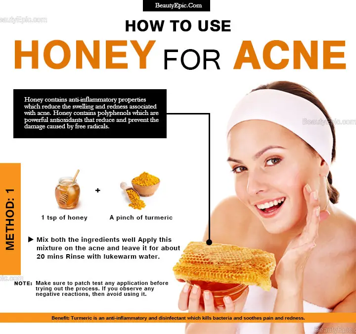honey for acne