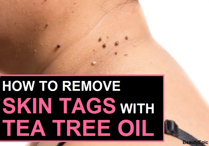 tea tree oil for skin tags