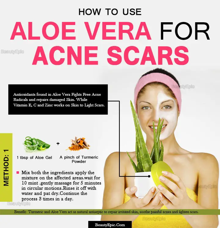 aloe vera for acne scars