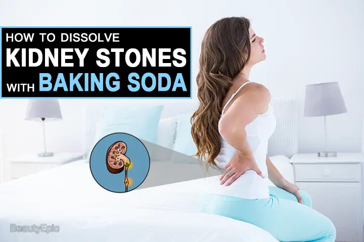 baking soda for kidney stones