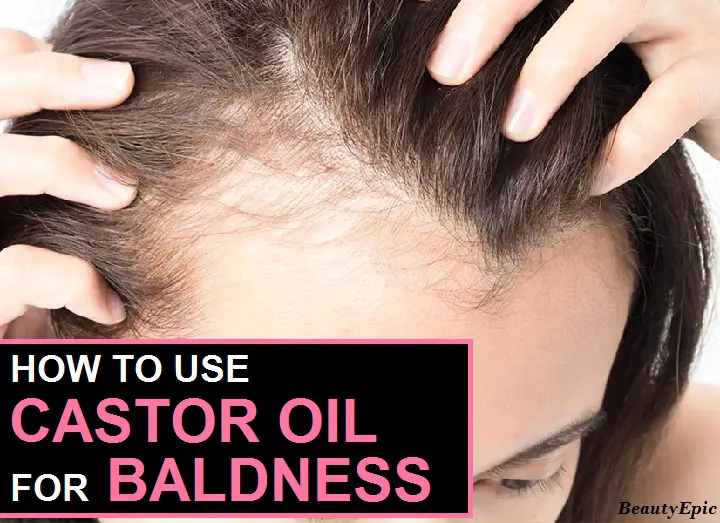 castor oil for baldness