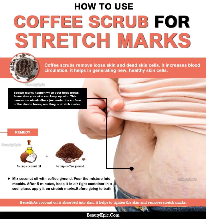 coffee scrub for stretch marks