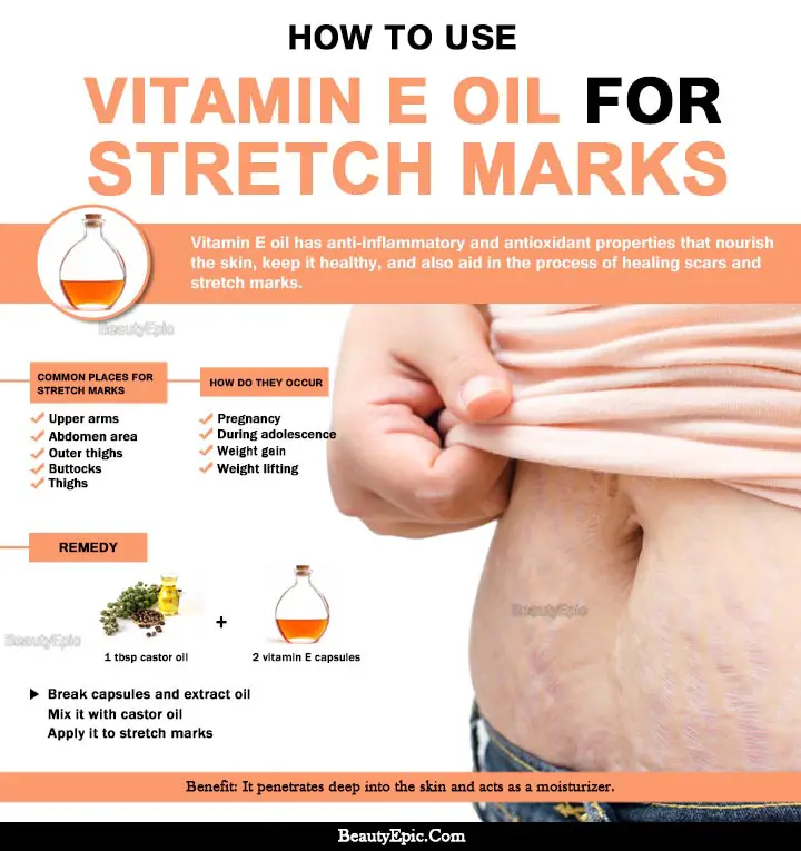 vitamin e oil for stretch marks