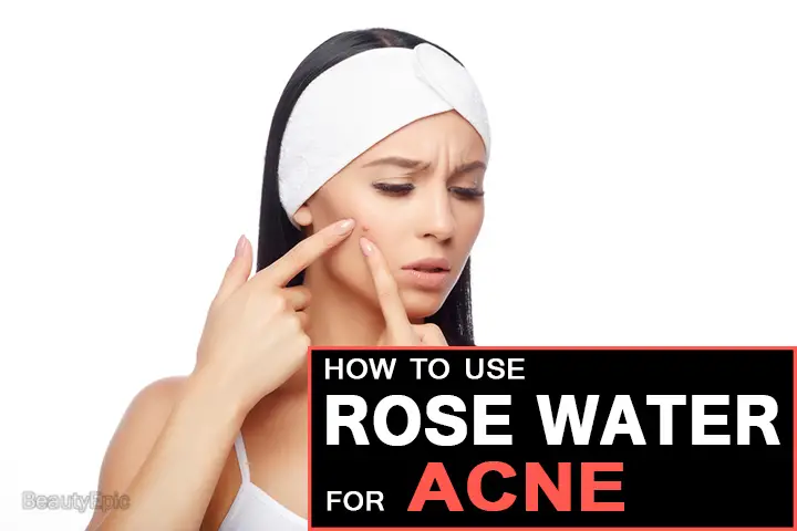 rose water for acne