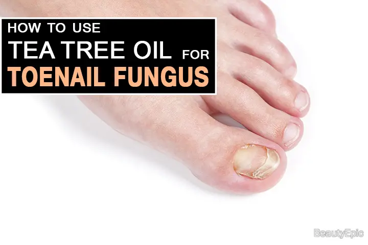 tea tree oil for toenail fungus