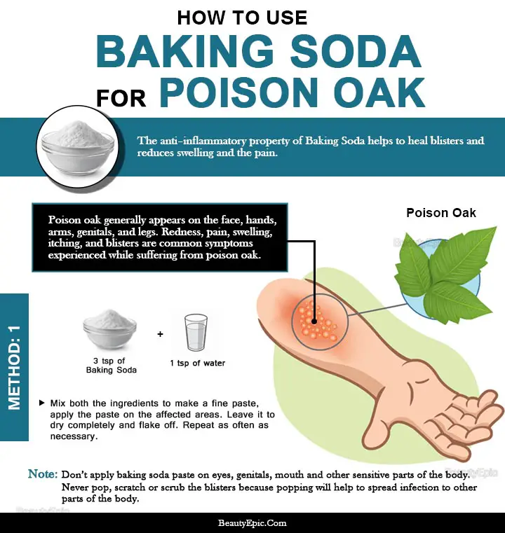 baking soda for poison oak