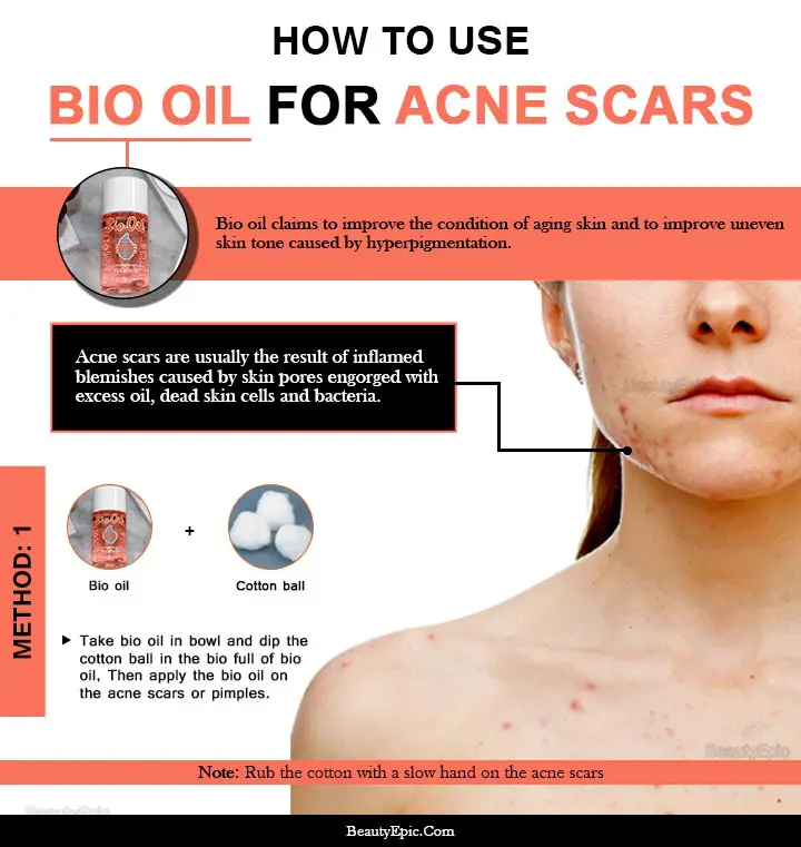 how to apply bio oil for acne scars