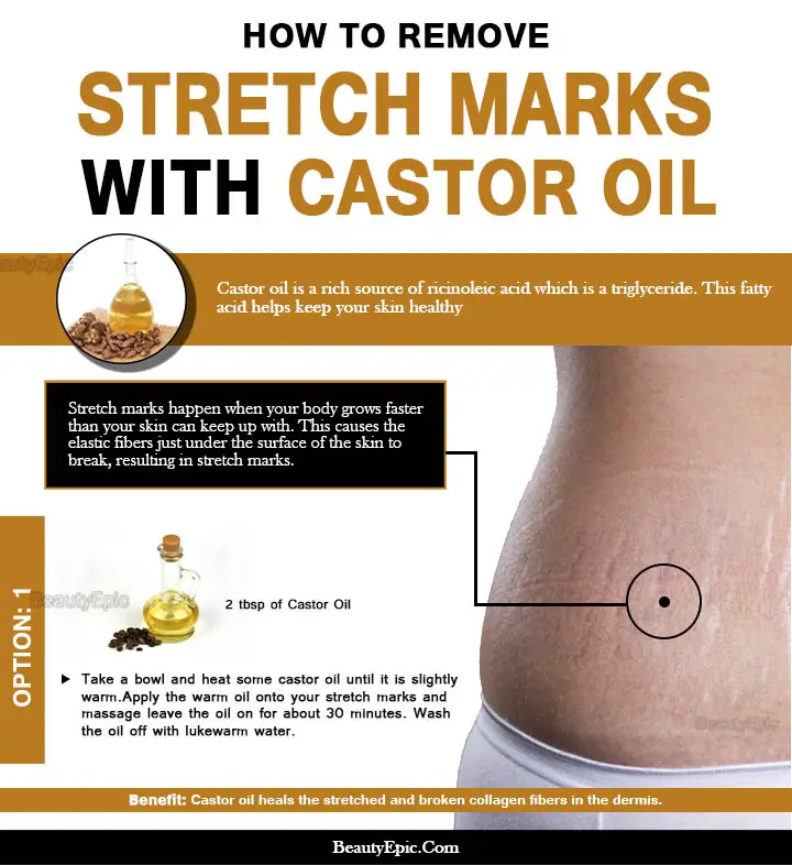 castor oil for stretch marks
