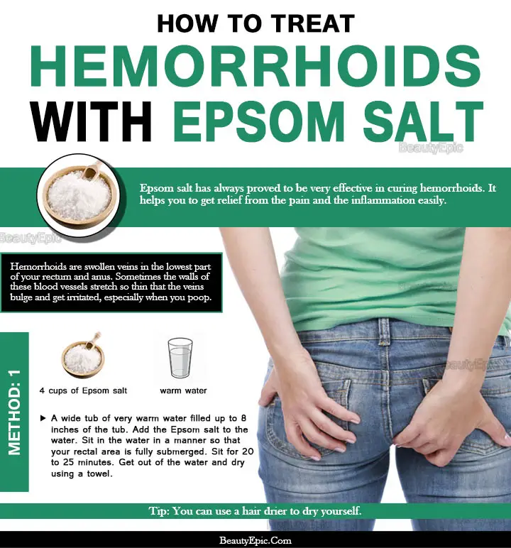 epsom salt for hemorrhoids