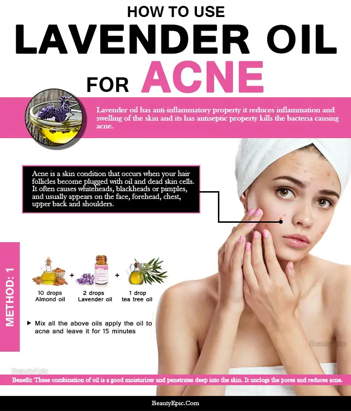 lavender oil for acne