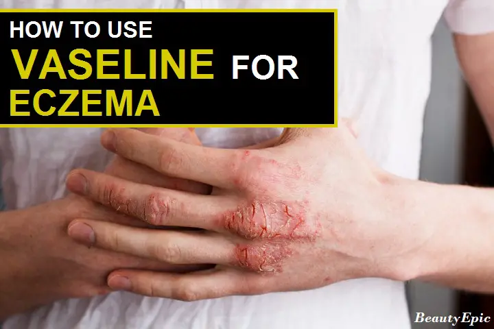 vaseline for eczema