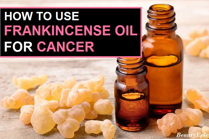 frankincense oil for cancer