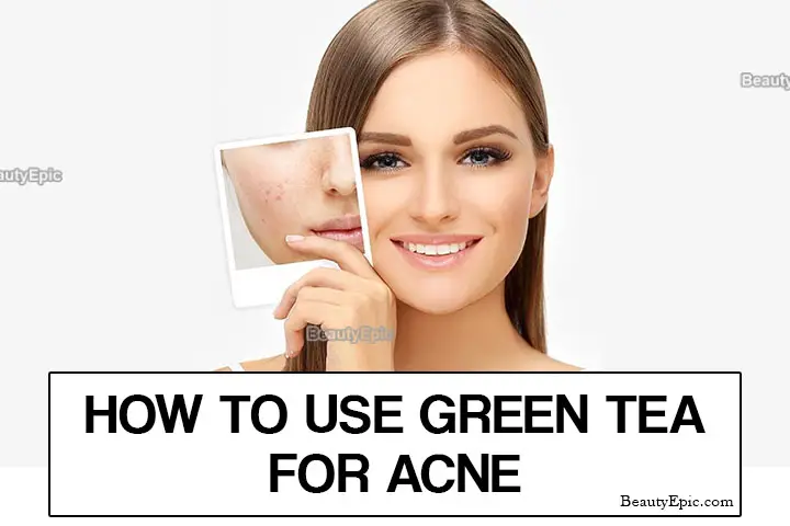 green tea for acne