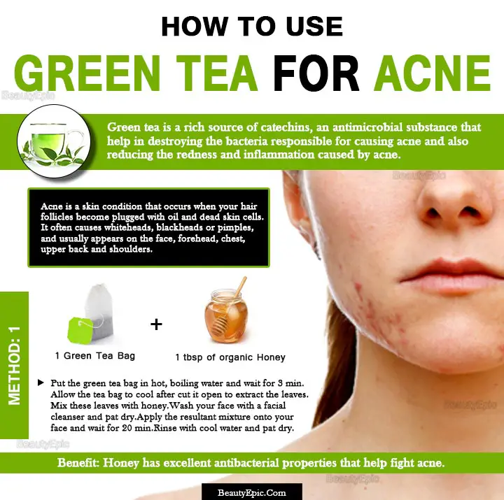 honey and green tea for acne