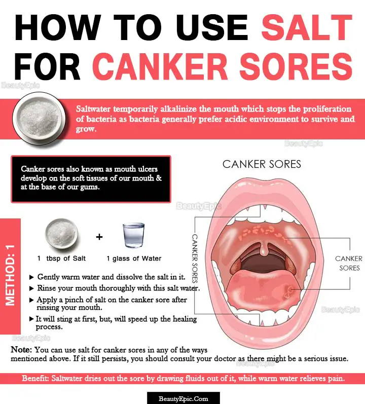 salt for canker sore