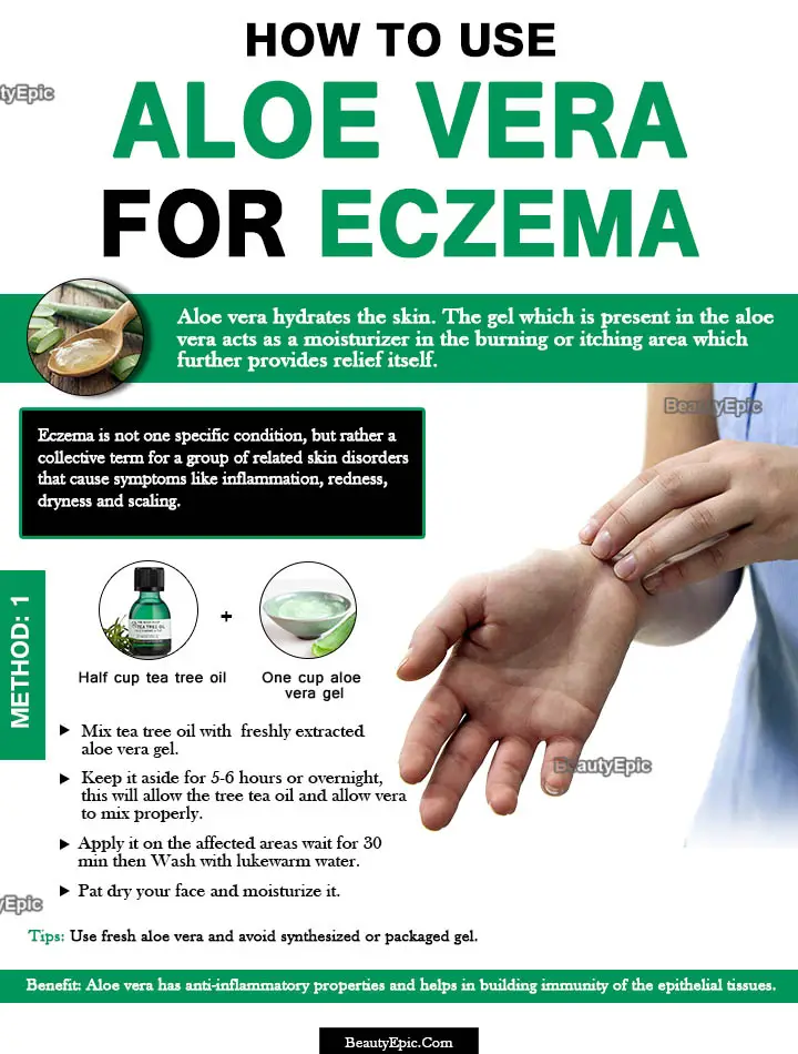 aloe vera for eczema