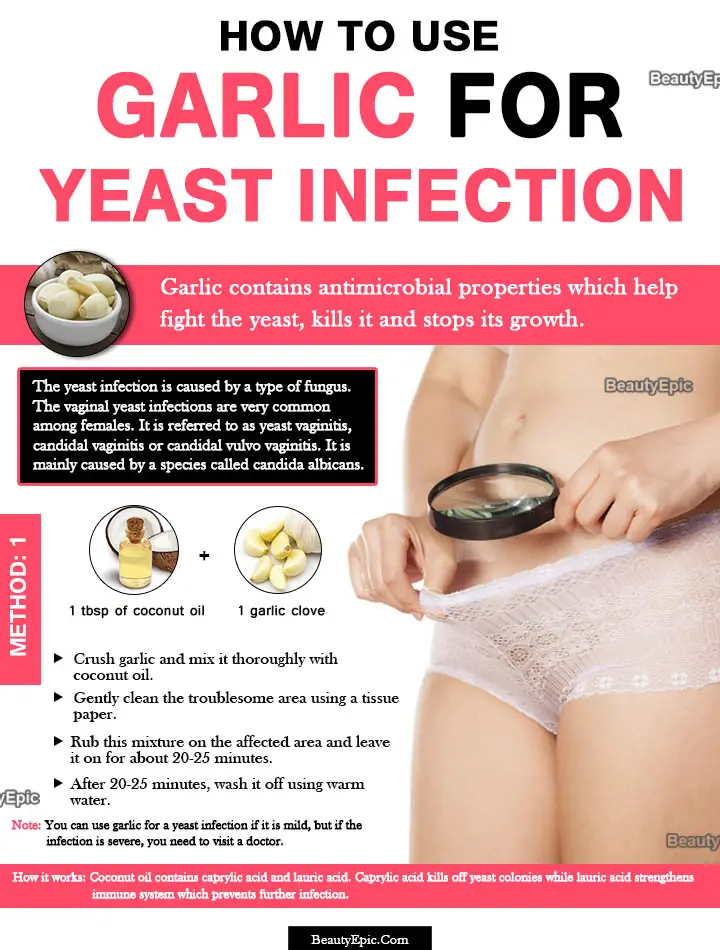 garlic for yeast infection