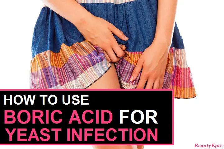 how to use boric acid for yeast infection