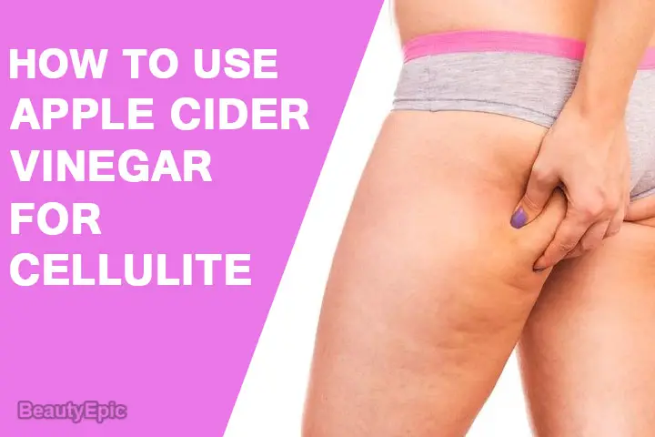 apple cider vinegar for cellulite