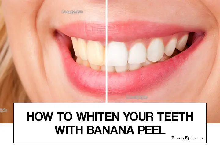 banana peel for whitening teeth