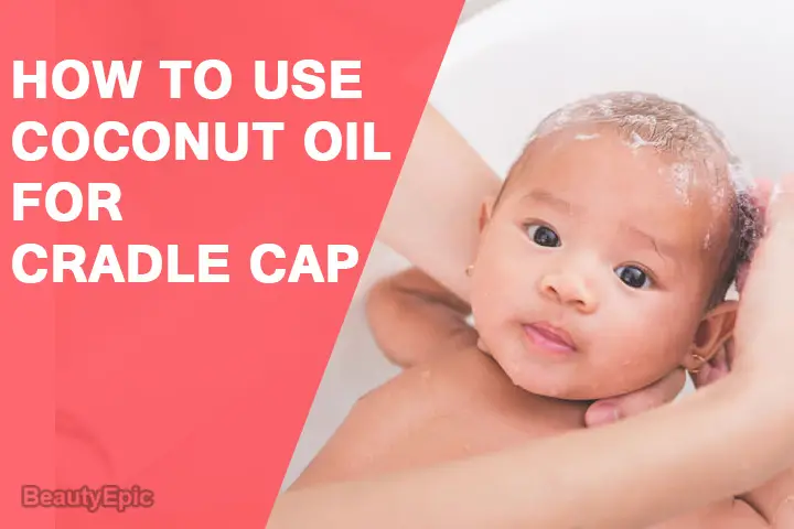 coconut oil for cradle cap