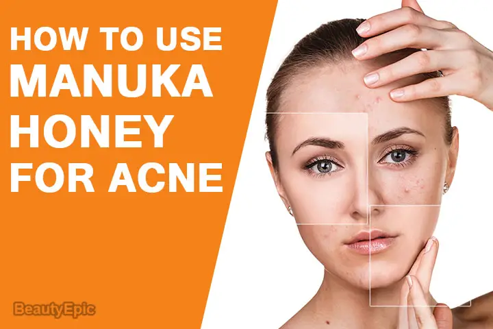 how to use manuka honey for acne