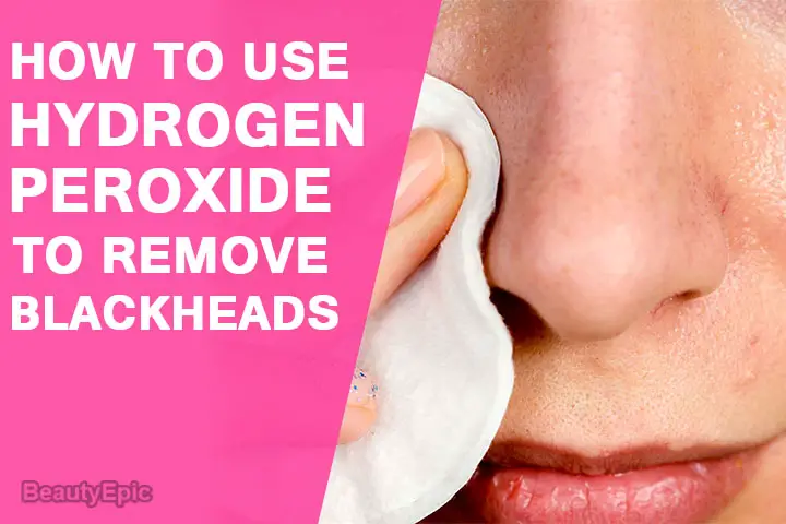 hydrogen peroxide for blackheads