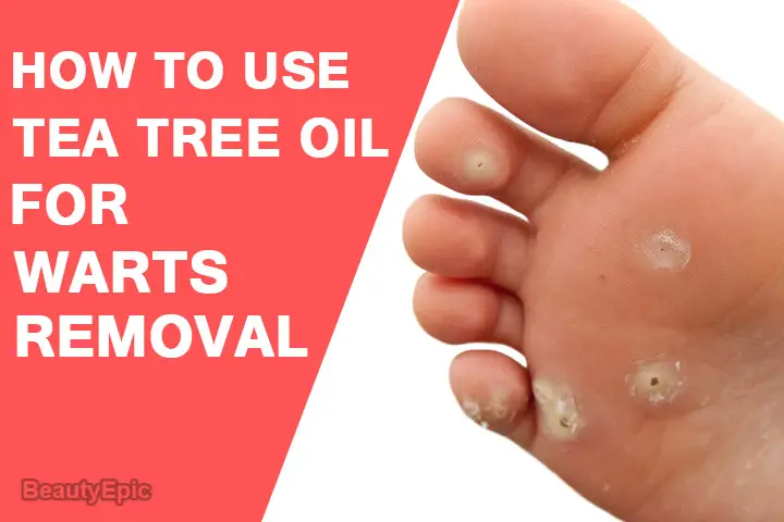 tea tree oil for warts