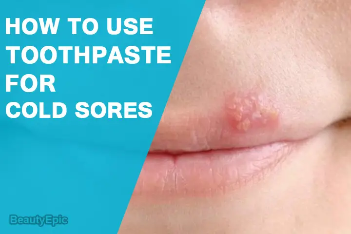 toothpaste on cold sore