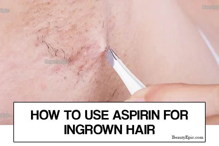 aspirin for ingrown hair