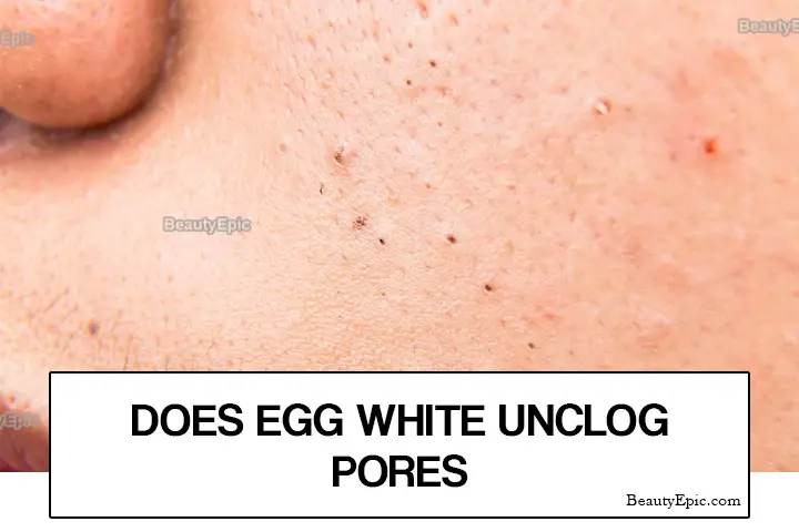 does egg white unclog pores