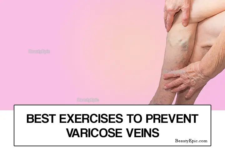 exercises for varicose veins