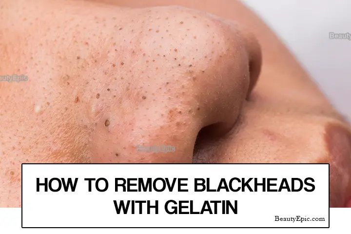 gelatin for blackheads