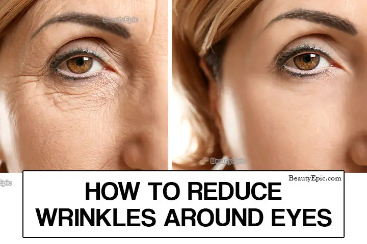 how to remove under eye wrinkles