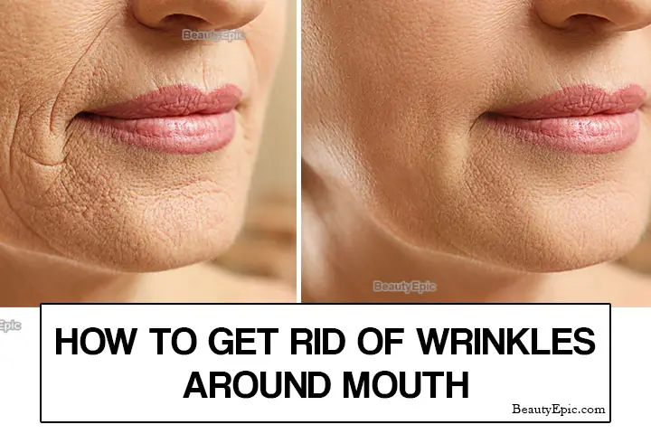 remedies for wrinkles around mouth