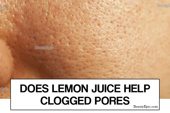 does lemon juice help clogged pores