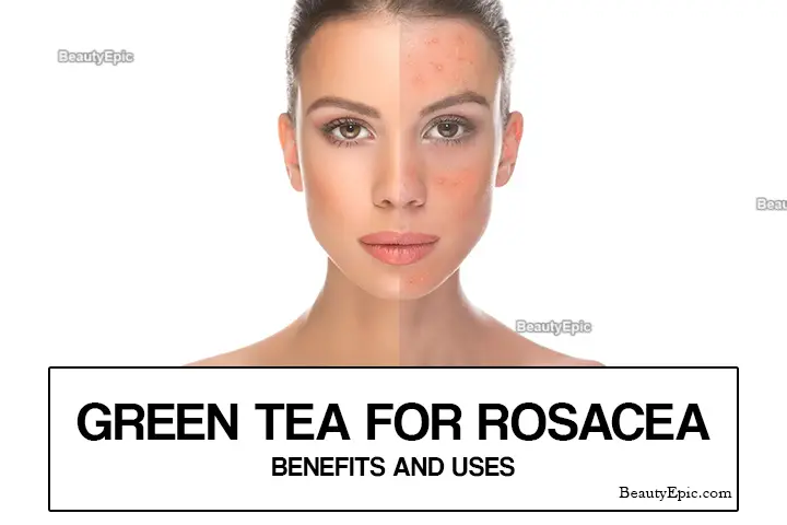 green tea for rosacea