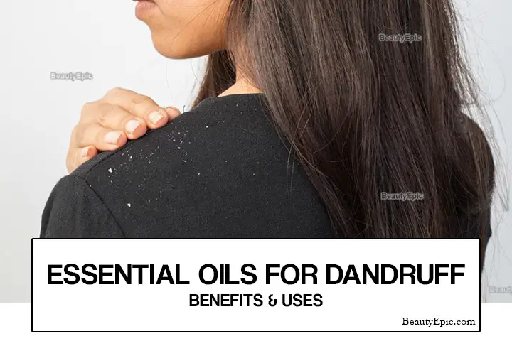 essential oils for dandruff