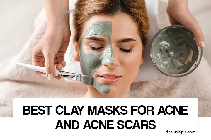 best clay masks for acne