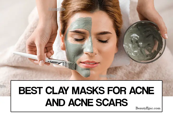 Best Clay Masks for Acne and acne Scars – Our Top 10