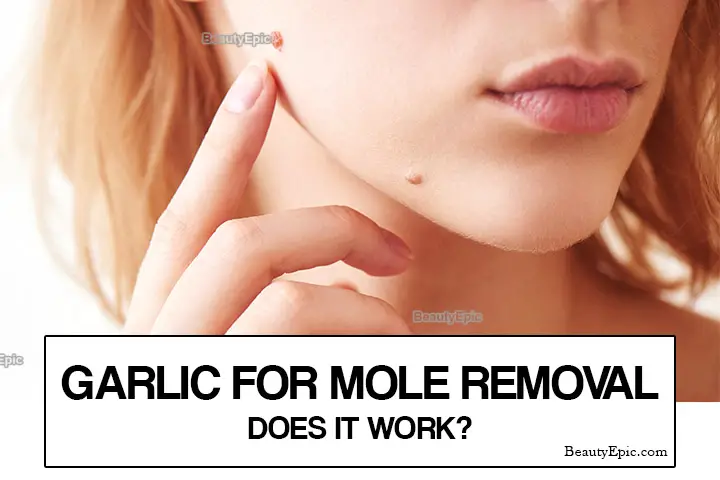 garlic for moles