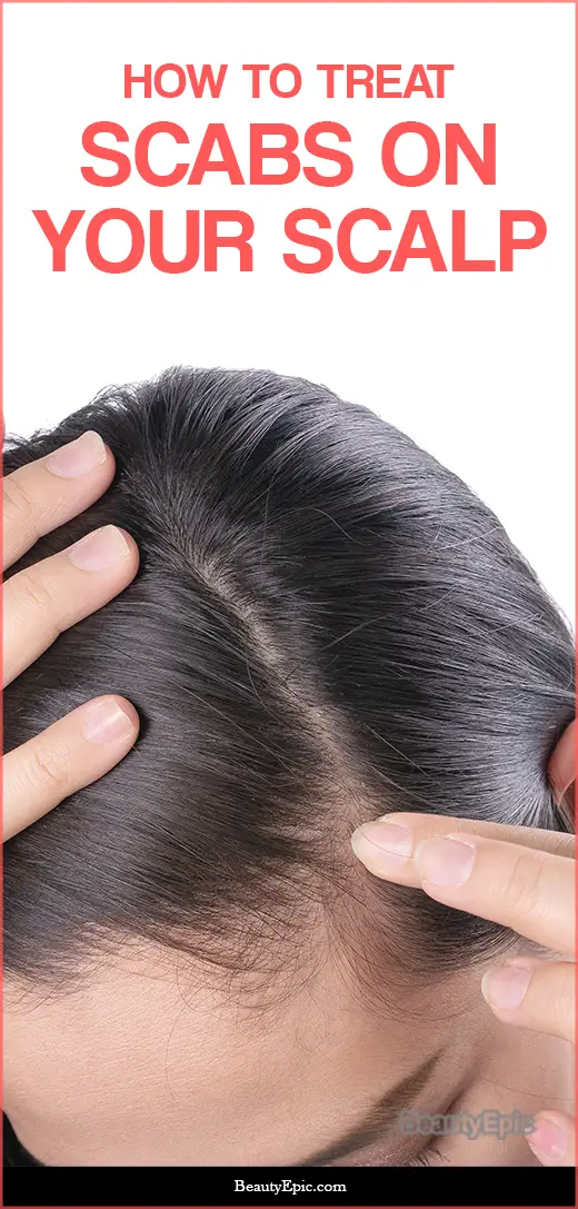 how to treat scabs on the scalp