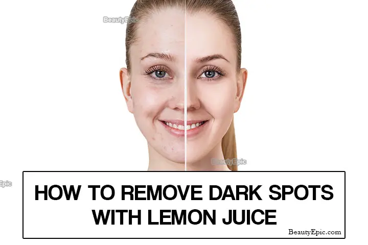 lemon juice for dark spots