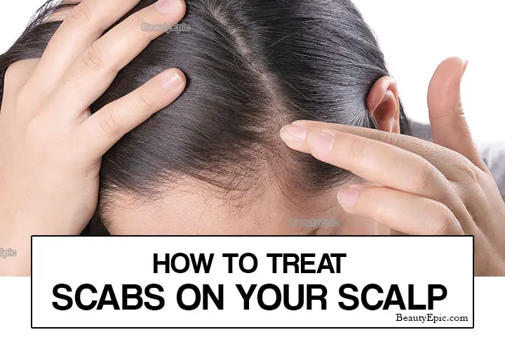 scabs on scalp