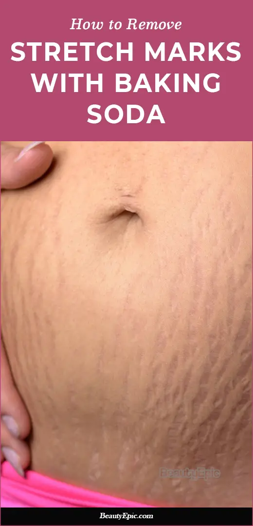 How to Use Baking Soda for Stretch Marks?