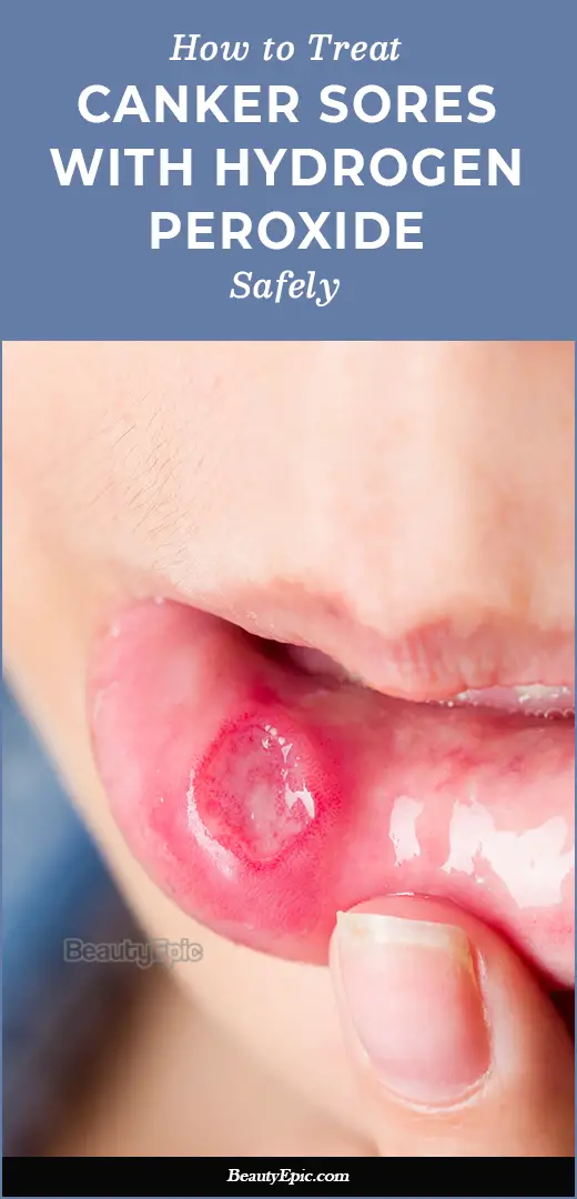 How to Safely Use Hydrogen Peroxide for Canker Sores?