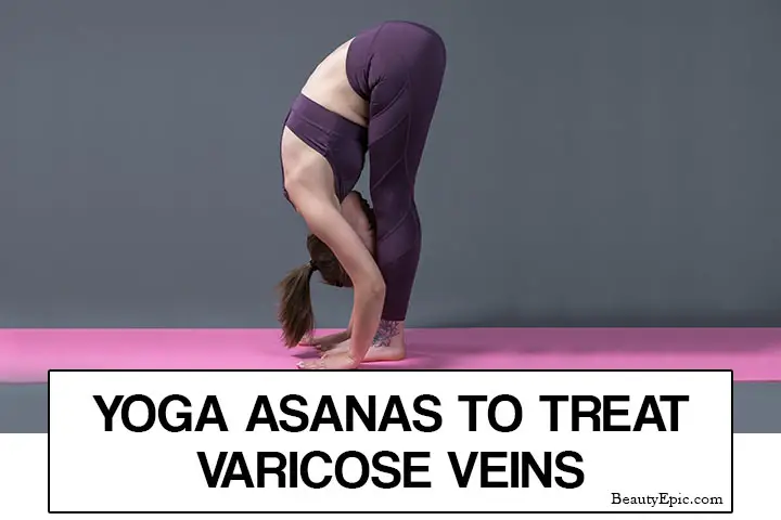 yoga for varicose veins