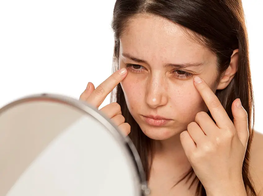 baking soda and lemon for dark circles