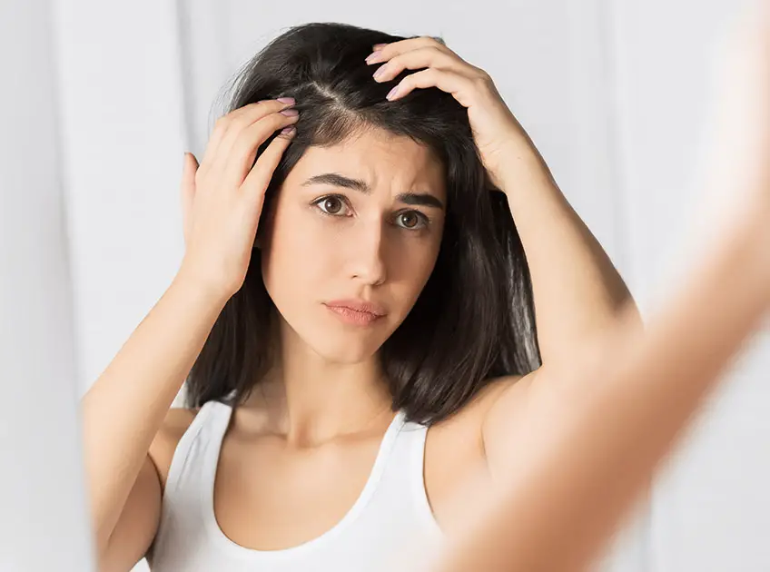 home remedies for dandruff