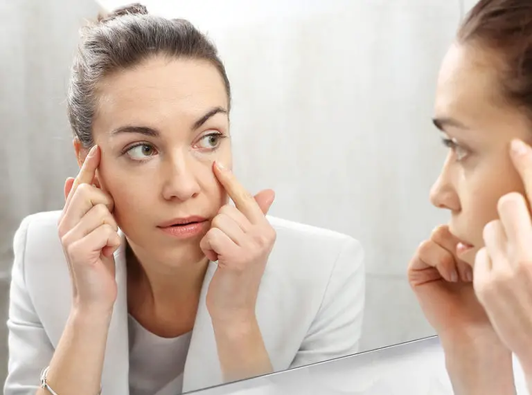 7 Simple Home Remedies For Puffy Eyes